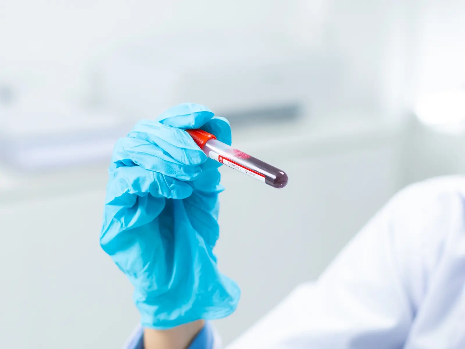 Naturheilpraxis Claus Jahn Labordiagnostik